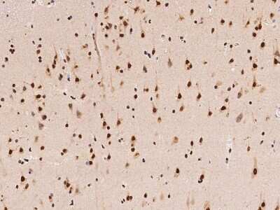 Immunohistochemistry-Paraffin: hnRNP A1 Antibody [NBP2-97829]