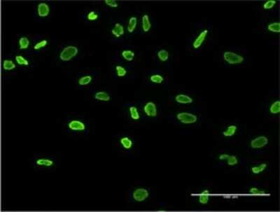 Immunocytochemistry/ Immunofluorescence: hnRNP A2B1 Antibody (3G11-6A7) [H00003181-M02]