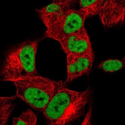Immunocytochemistry/ Immunofluorescence: hnRNP A2B1 Antibody [NBP2-56497]