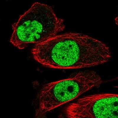 Immunocytochemistry/ Immunofluorescence: hnRNP A2B1 Antibody [NBP2-58872]