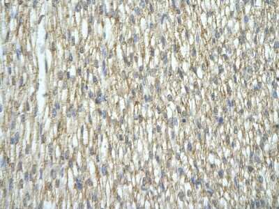 Immunohistochemistry: hnRNP A2B1 Antibody [NBP1-57166]