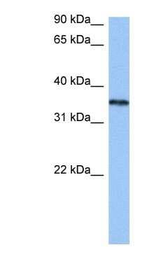 Western Blot: hnRNP A2B1 Antibody [NBP1-57166]