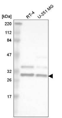 Western Blot: hnRNP A2B1 Antibody [NBP2-58872]
