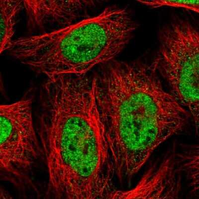 Immunocytochemistry/ Immunofluorescence: hnRNP AB Antibody [NBP1-91999]