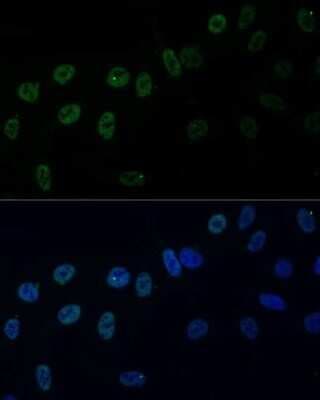 Immunocytochemistry/ Immunofluorescence: hnRNP AB Antibody - Azide and BSA Free [NBP3-03424]