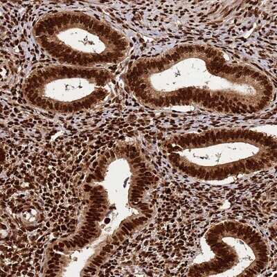 Immunohistochemistry-Paraffin: hnRNP AB Antibody [NBP1-91999]
