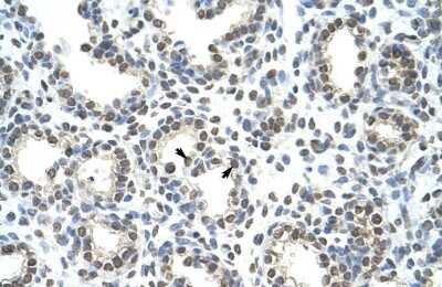 Immunohistochemistry-Paraffin: hnRNP AB Antibody [NBP2-87582]
