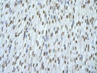 Immunohistochemistry-Paraffin: hnRNP AB Antibody [NBP2-87582]