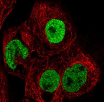 Immunocytochemistry/ Immunofluorescence: hnRNP C1 + C2 Antibody (CL2596) [NBP2-36777]