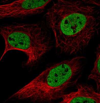Immunocytochemistry/ Immunofluorescence: hnRNP C1 + C2 Antibody (CL2596) [NBP2-36777]