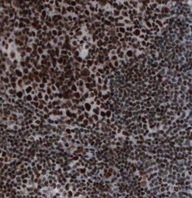 Immunohistochemistry: hnRNP C1 + C2 Antibody (CL2596) [NBP2-36777]