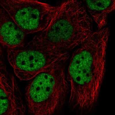 Immunocytochemistry/ Immunofluorescence: hnRNP F Antibody [NBP2-57442]