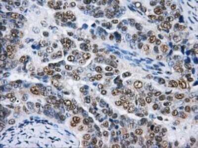 Immunohistochemistry: hnRNP F Antibody (OTI5F5) - Azide and BSA Free [NBP2-70907]