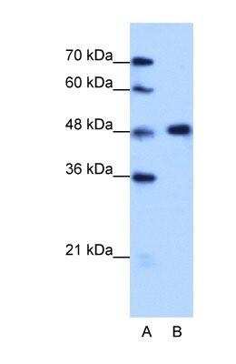 Western Blot: hnRNP F Antibody [NBP1-57273]