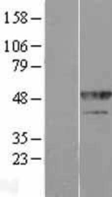 Western Blot: hnRNP F Overexpression Lysate [NBP2-11439]