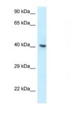 Western Blot: hnRNP G Antibody [NBP1-79904]