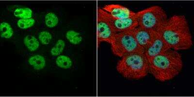 Immunocytochemistry/ Immunofluorescence: hnRNP H Antibody [NBP1-31648]