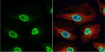Immunocytochemistry/ Immunofluorescence: hnRNP H Antibody [NBP1-31648]