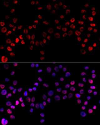 Immunocytochemistry/ Immunofluorescence: hnRNP H Antibody - Azide and BSA Free [NBP2-93590]