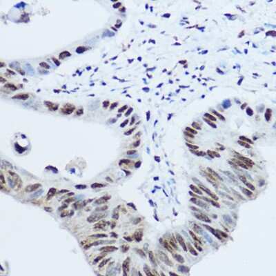 Immunohistochemistry-Paraffin: hnRNP H Antibody - Azide and BSA Free [NBP2-93590]