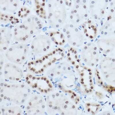 Immunohistochemistry-Paraffin: hnRNP H Antibody - Azide and BSA Free [NBP2-93590]