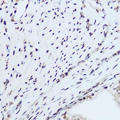 Immunohistochemistry-Paraffin: hnRNP H Antibody - Azide and BSA Free [NBP2-93590]