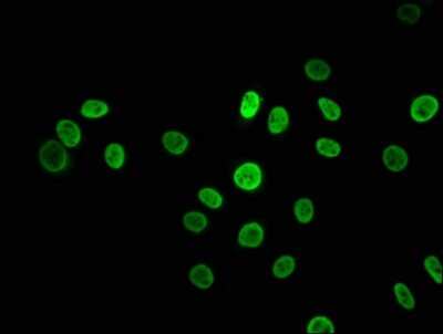 Immunocytochemistry/ Immunofluorescence: hnRNP K Antibody (3G7) [NBP3-15177]