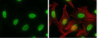 Immunocytochemistry/ Immunofluorescence: hnRNP K Antibody [NBP1-30975]