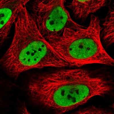 Immunocytochemistry/ Immunofluorescence: hnRNP K Antibody [NBP2-58067]