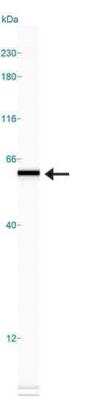 Simple Western: hnRNP K Antibody [NBP2-24532]