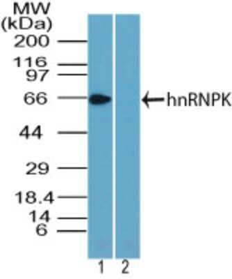 Western Blot: hnRNP K Antibody [NBP2-24531]