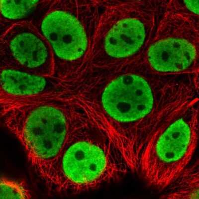 Immunocytochemistry/ Immunofluorescence: hnRNP L Antibody [NBP2-38675]