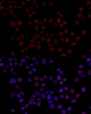 Immunocytochemistry/ Immunofluorescence: hnRNP L Antibody - BSA Free [NBP3-03641]