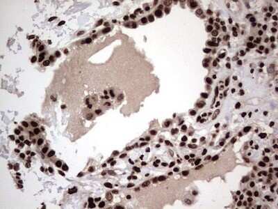 Immunohistochemistry: hnRNP L Antibody (OTI2E4) - Azide and BSA Free [NBP2-70908]