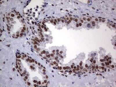 Immunohistochemistry: hnRNP L Antibody (OTI2E4) - Azide and BSA Free [NBP2-70908]
