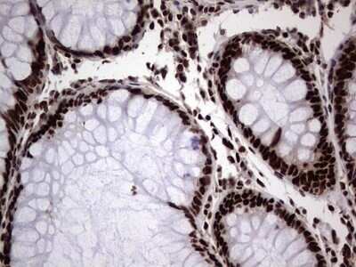 Immunohistochemistry: hnRNP L Antibody (OTI2E4) - Azide and BSA Free [NBP2-70908]
