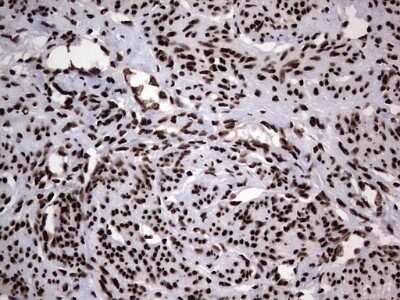 Immunohistochemistry: hnRNP L Antibody (OTI2E4) - Azide and BSA Free [NBP2-70908]