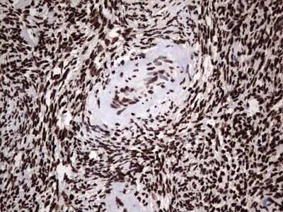 Immunohistochemistry: hnRNP L Antibody (OTI2E4) - Azide and BSA Free [NBP2-70908]