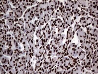 Immunohistochemistry: hnRNP L Antibody (OTI2E4) - Azide and BSA Free [NBP2-70908]