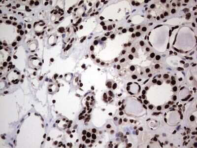 Immunohistochemistry: hnRNP L Antibody (OTI2E4) [NBP2-45990]