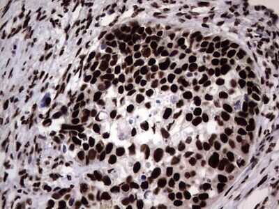 Immunohistochemistry: hnRNP L Antibody (OTI2E4) [NBP2-45990]