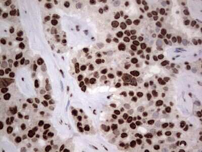 Immunohistochemistry: hnRNP L Antibody (OTI2E4) [NBP2-45990]