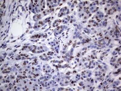 Immunohistochemistry: hnRNP L Antibody (OTI2E4) [NBP2-45990]