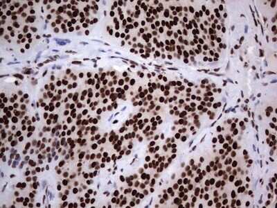 Immunohistochemistry: hnRNP L Antibody (OTI2E4) [NBP2-45990]