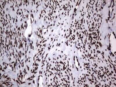 Immunohistochemistry: hnRNP L Antibody (OTI2E4) [NBP2-45990]