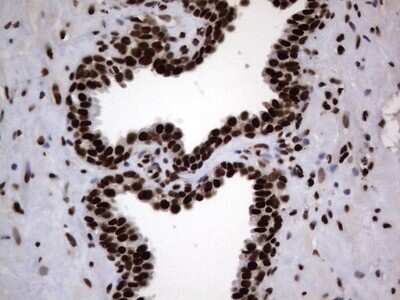 Immunohistochemistry: hnRNP L Antibody (OTI2E4) [NBP2-45990]