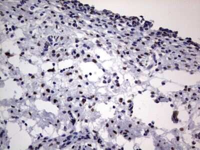 Immunohistochemistry: hnRNP L Antibody (OTI2E4) [NBP2-45990]