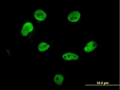 Immunocytochemistry/ Immunofluorescence: hnRNP M Antibody (3F7) [H00004670-M03]