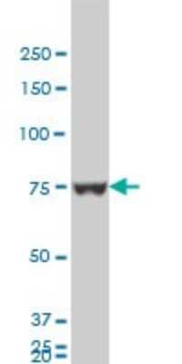 Western Blot: hnRNP M Antibody (3F7) [H00004670-M03]