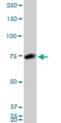 Western Blot: hnRNP M Antibody (3F7) [H00004670-M03]